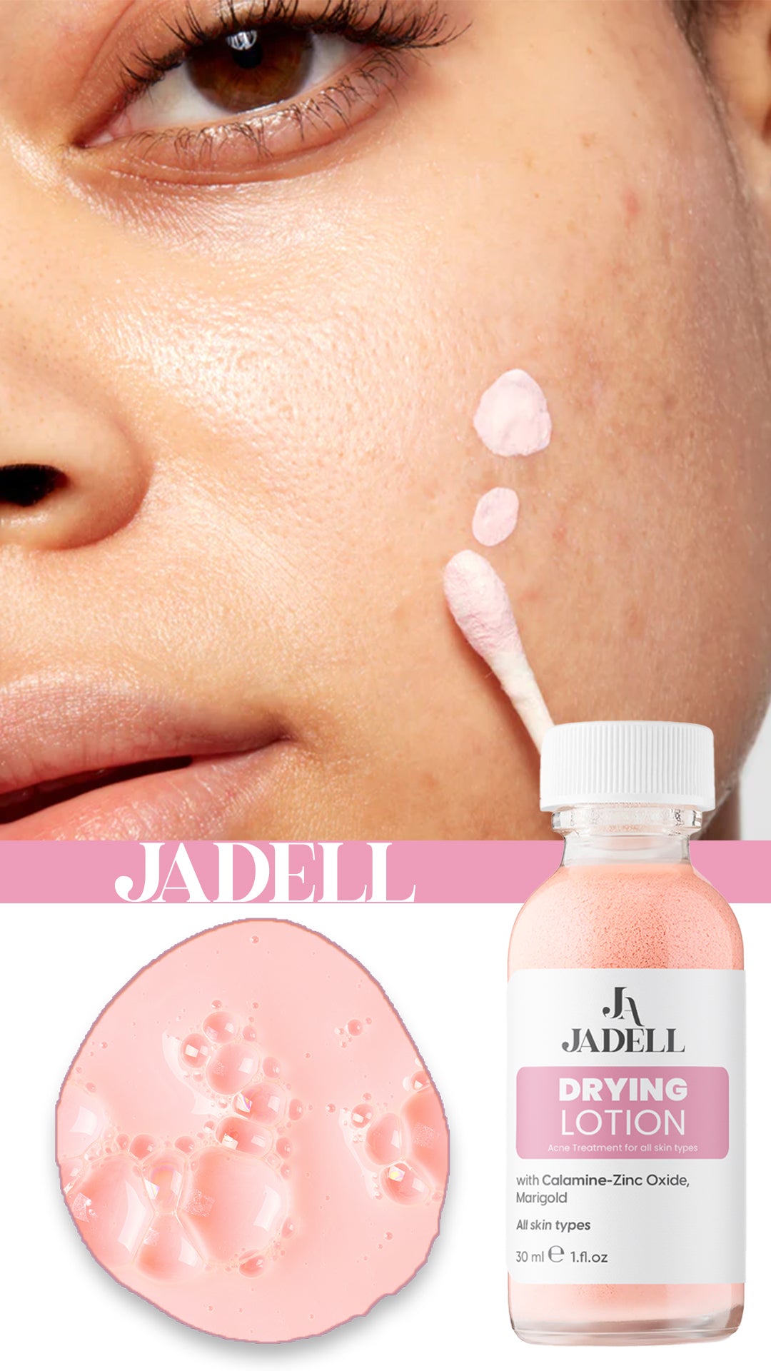 JADELL SİVİLCE AKNE MASKESİ